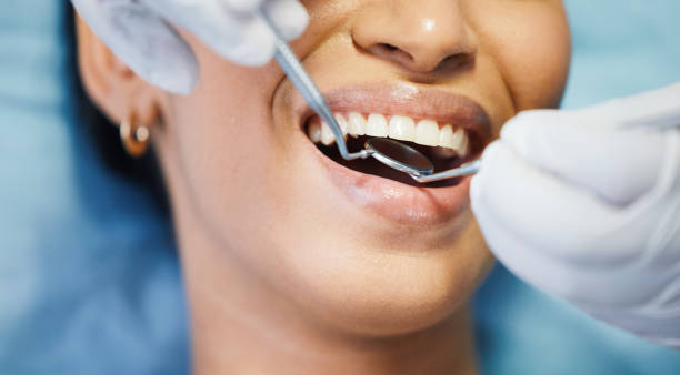 Best Broken or Chipped Tooth Repair in Pleasant View, UT